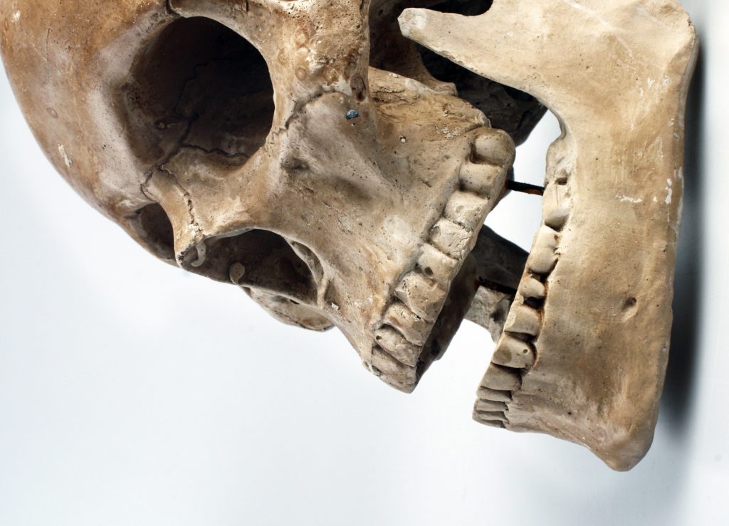 skull-color-teeth-46510