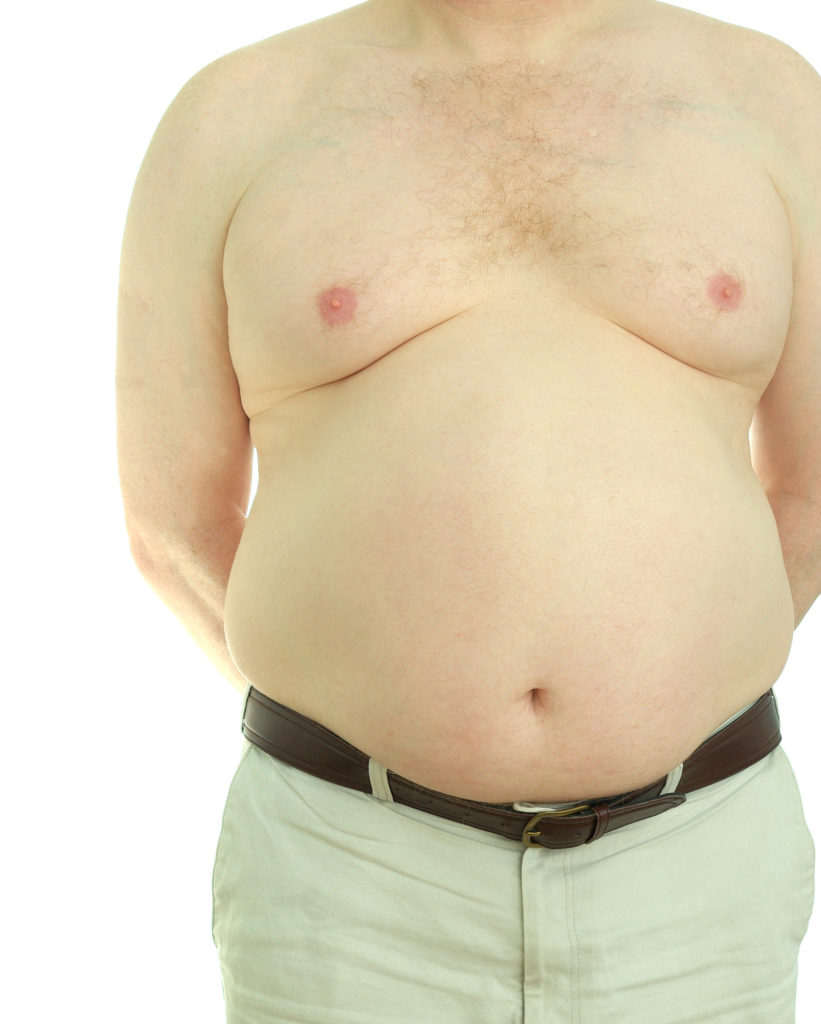 Front view of an overweight, middle-aged man naked from the waist up.